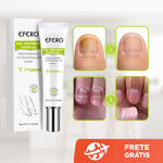 Efero Cream - Creme Anti-Inflamatório Para Remoção de Fungos - Saúde no Cotidiano