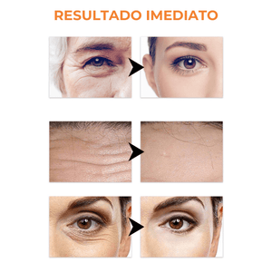 Collagen Skin Botox™ - Colágeno + Ácido Hialurônico [Tratamento de 2 Meses] +BRINDE