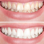 Clareador Dental Viya White  PROMOÇÃO (60% DE DESCONTO)