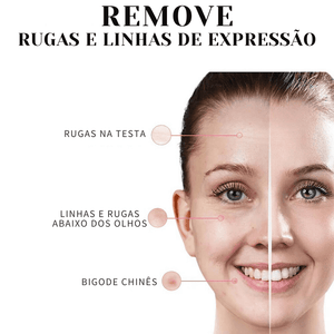 Collagen Skin Botox™ - Colágeno + Ácido Hialurônico [Tratamento de 2 Meses] +BRINDE