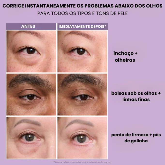 Firmador instantâneo para os olhos – Rejuvenesça em minutos e dure o dia todo - Saúde no Cotidiano