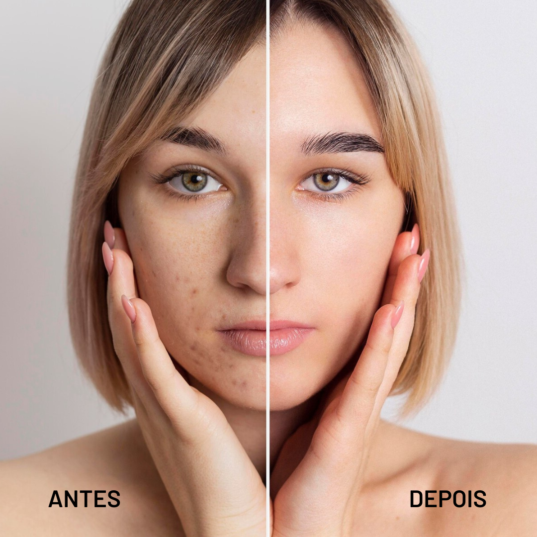 Base TLM 4 em 1 | Cobertura Top e Adaptação Perfeita ao Teu Tom