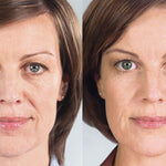 BotoxLux™ Creme Lifting com Peptídeos