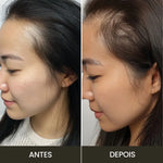 Kit Anti-Queda | Escova Therabrush & Óleo de Alecrim