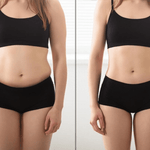 Adesivo de Umbigo para Emagrecimento - Saúde Detox