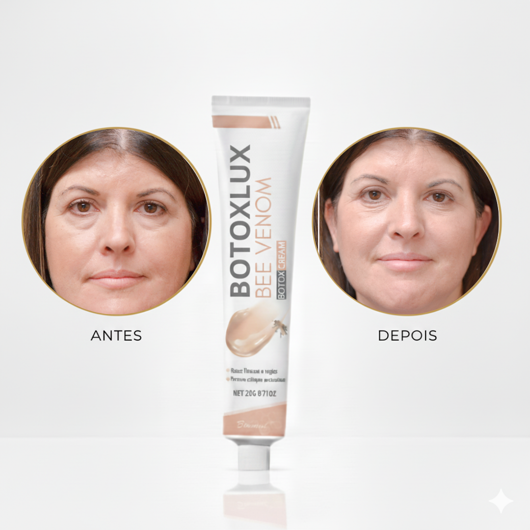 BotoxLux™ Creme Lifting com Peptídeos