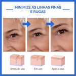 Sérum Concentrado Anti-Idade Efeito Botox