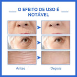 Sérum Concentrado Anti-Idade Efeito Botox