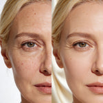 Collagen Skin Botox™ - Colágeno + Ácido Hialurônico - Saúde no Cotidiano