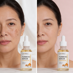Turmeric Sérum® - Corretor de Manchas Escuras