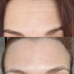 Retinal Cream™ | Creme Facial Firmador com Retinal