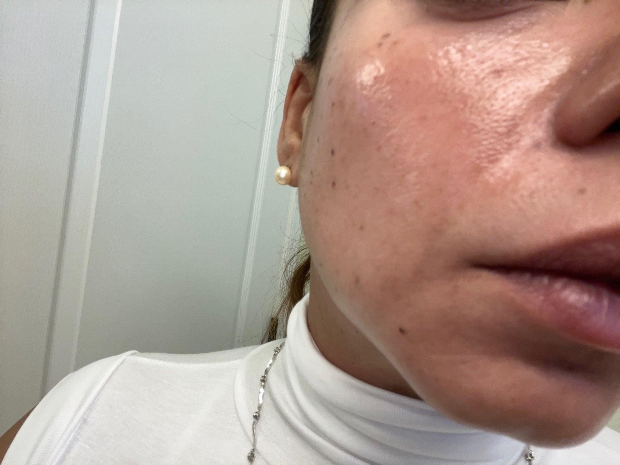 Aparelho Peeling Ultrassônico Limpeza Facial – Pele Radiante - Saúde no Cotidiano