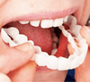 Sorriso Perfeito™️ Dentaduras removíveis - Saúde no Cotidiano