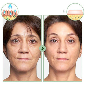 Máscara de Colágeno Reafirmante e Hidratante para Pele - Skin Collagen - Saúde no Cotidiano