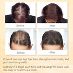 Óleo Natural para Queda de Cabelo - Pure Hair - Saúde no Cotidiano